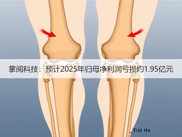 掌阅科技：预计2025年归母净利润亏损约1.95亿元(图3)